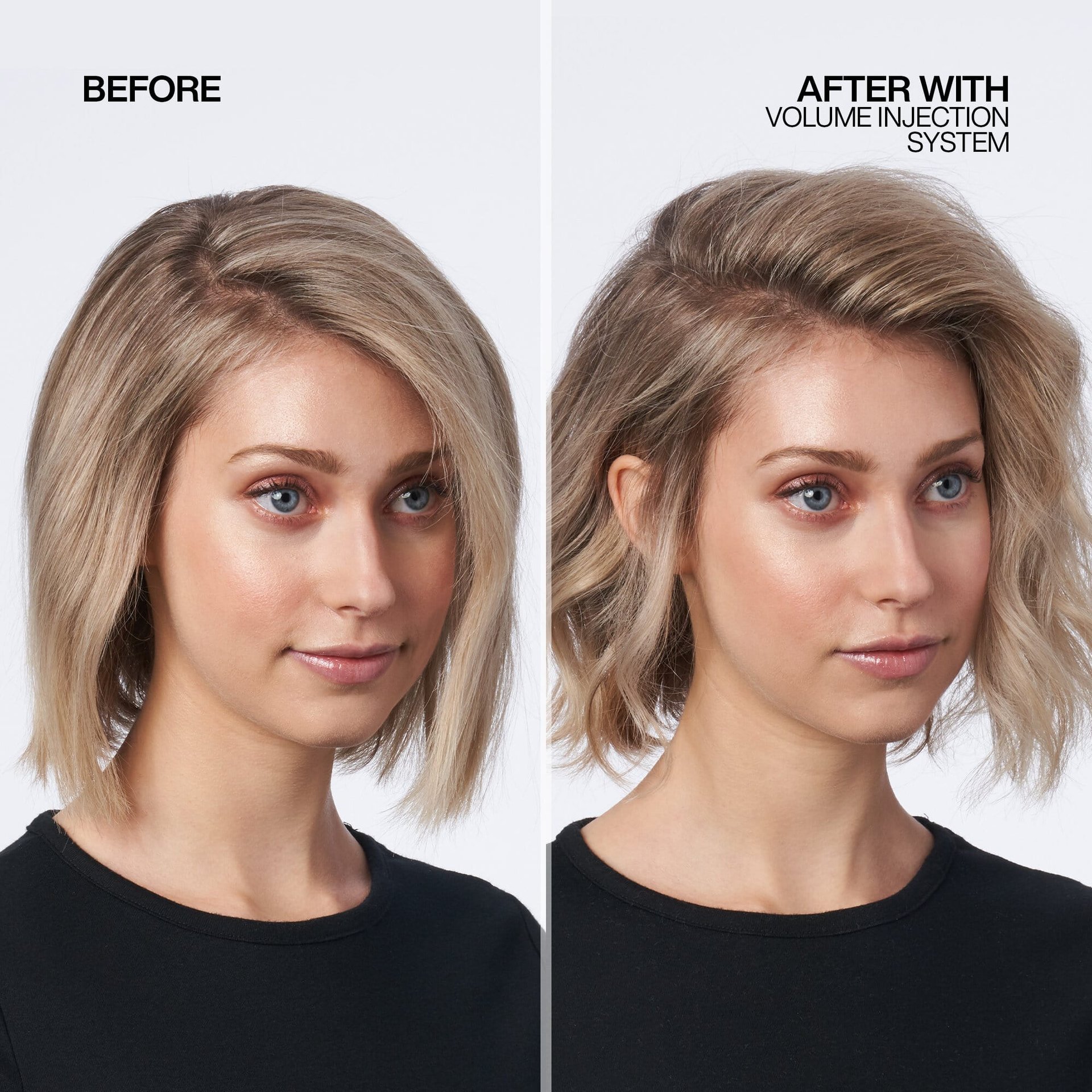 VOLUME INJECTION before after